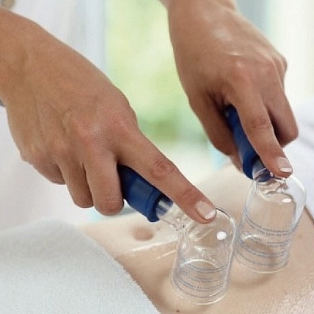 Vakuuma masāža sejai un ķermenim teorija +prakse