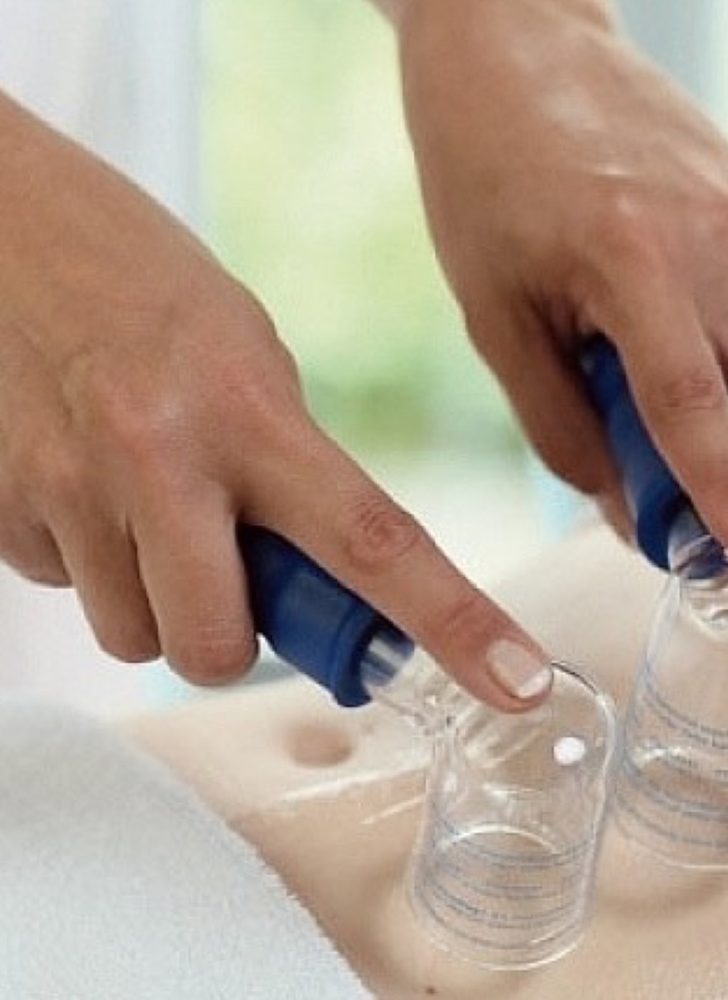 Vakuumasāžas metodes pielietojums sejai un ķermenim